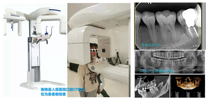 衡南县人民医院引进新口腔ctcbct与种植牙技术